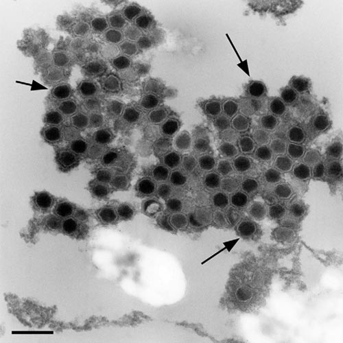 Ranavirus door een electronenmicroscoop Foto: Kirstin Rohn